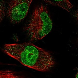 ZNF749 Antibody, Novus Biologicals:Antibodies:Primary Antibodies